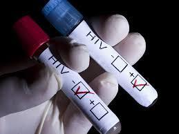 40-90 percent of people who have been infected with HIV have symptoms that are similar to the flu. 