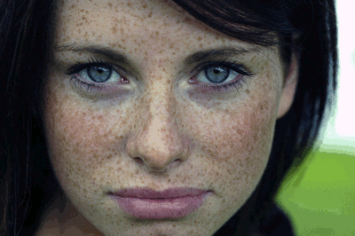 Freckles — maybe you have them. Maybe you don't.