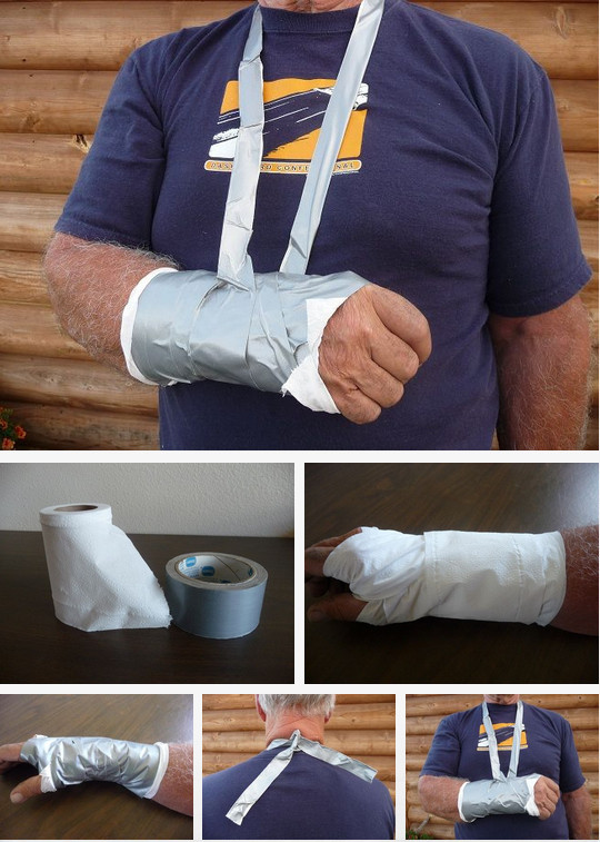 If you can't get to the hospital, you can set a broken arm with toilet paper and duct tape. 