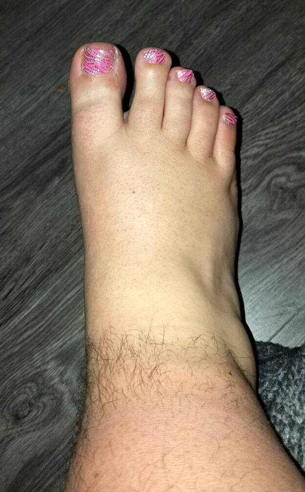 2. My Husband Bet Me I Couldn't Shave His Foot Without Him Waking Up. This Is What He Woke Up To This Morning