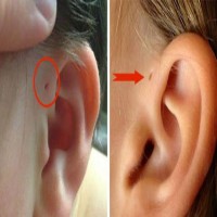 This is Why Some People Have Those Little Holes Above Their Ears